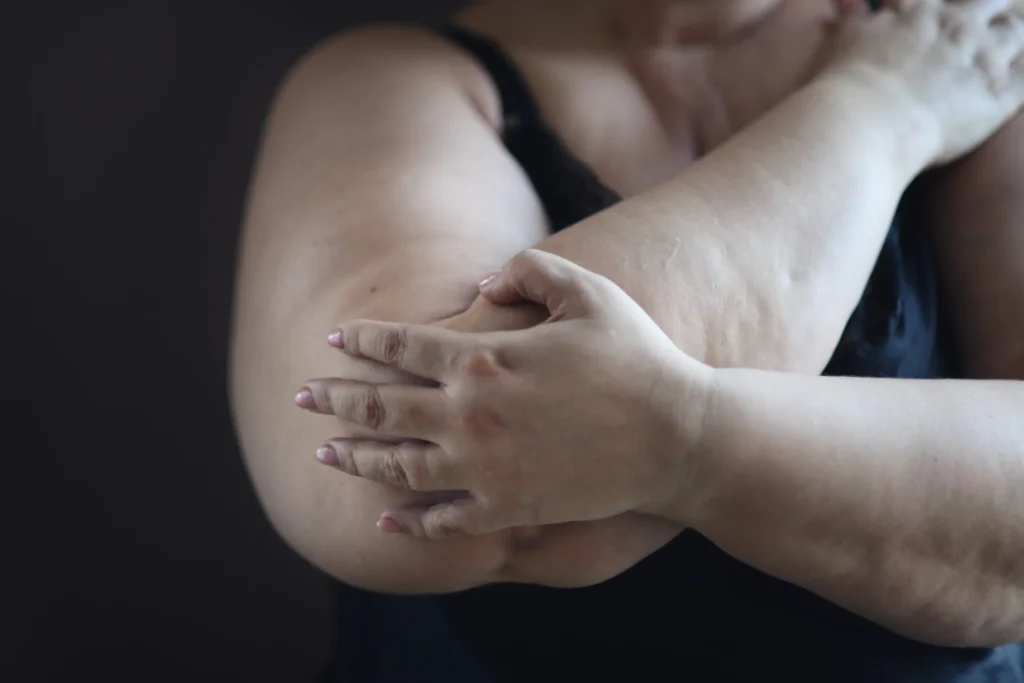 Obese truck drivers face increased health risks due to prolonged sitting and limited access to exercise facilities.